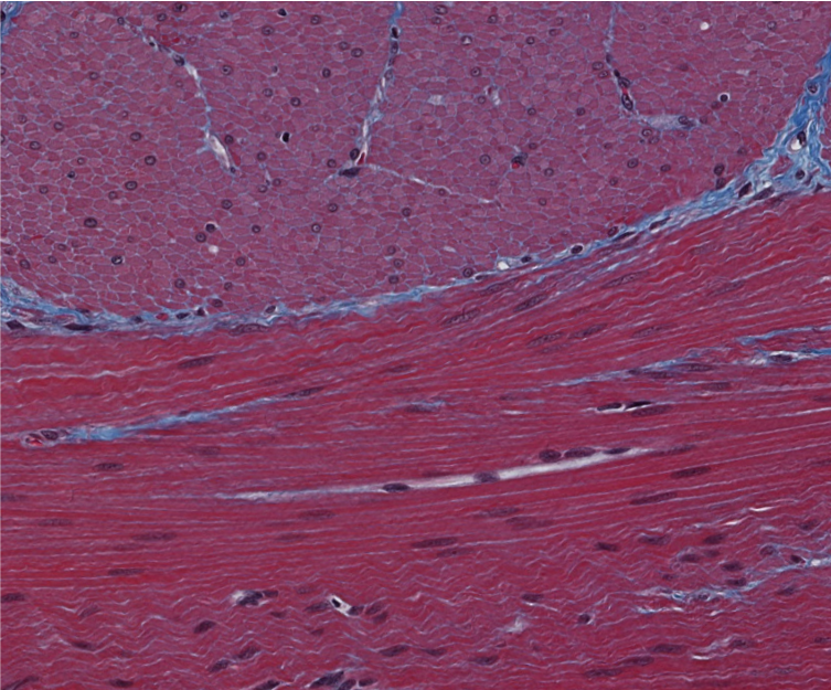 <p><span style="font-family: "Calibri Light";">ID the type of muscle.</span></p>