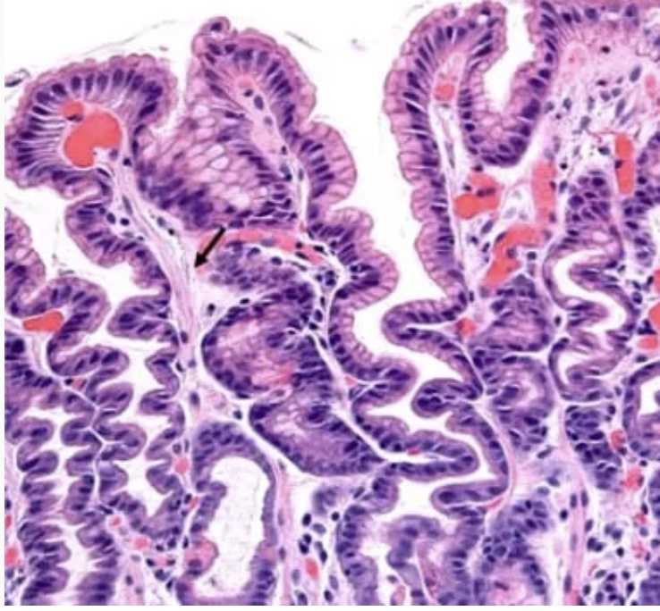 <p>1) Diagnostic</p><p>2) Causes</p>