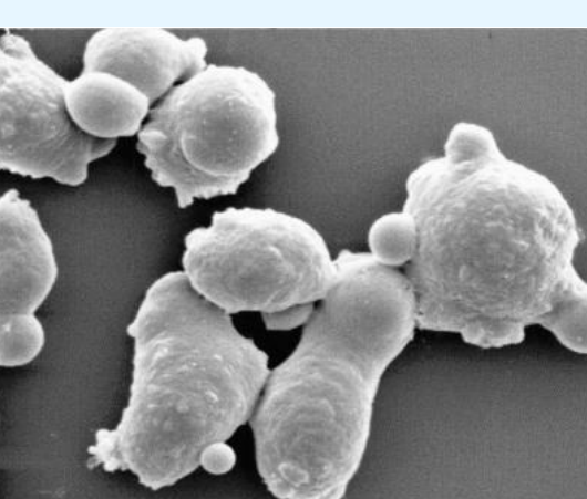 <p>What type of protozoan is this likely?</p>