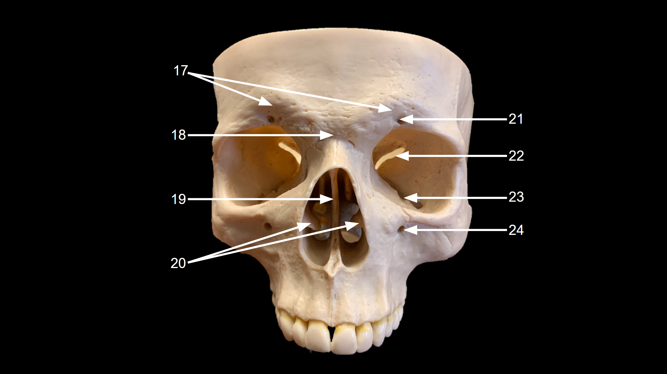 <p>WHAT IS 24 CALLED?</p>