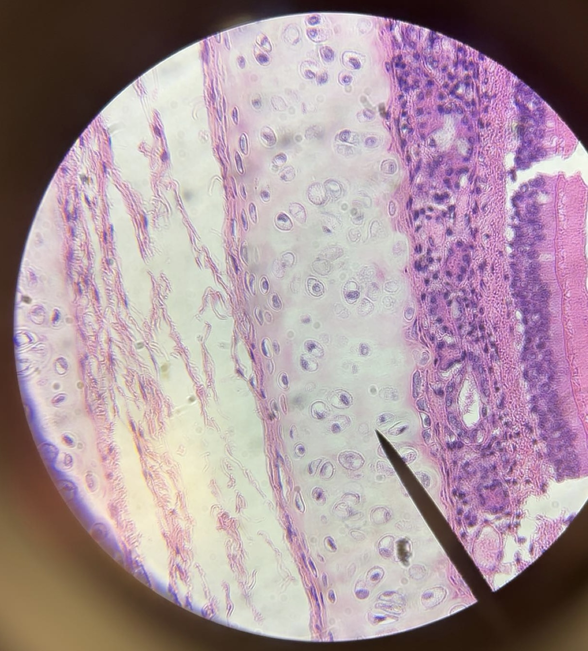 <p>tissue</p>