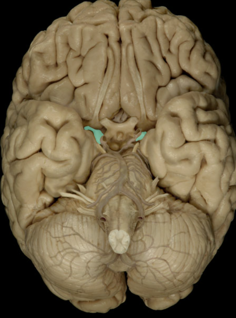 <p>Identify the artery to the brain (circle of willis)</p>