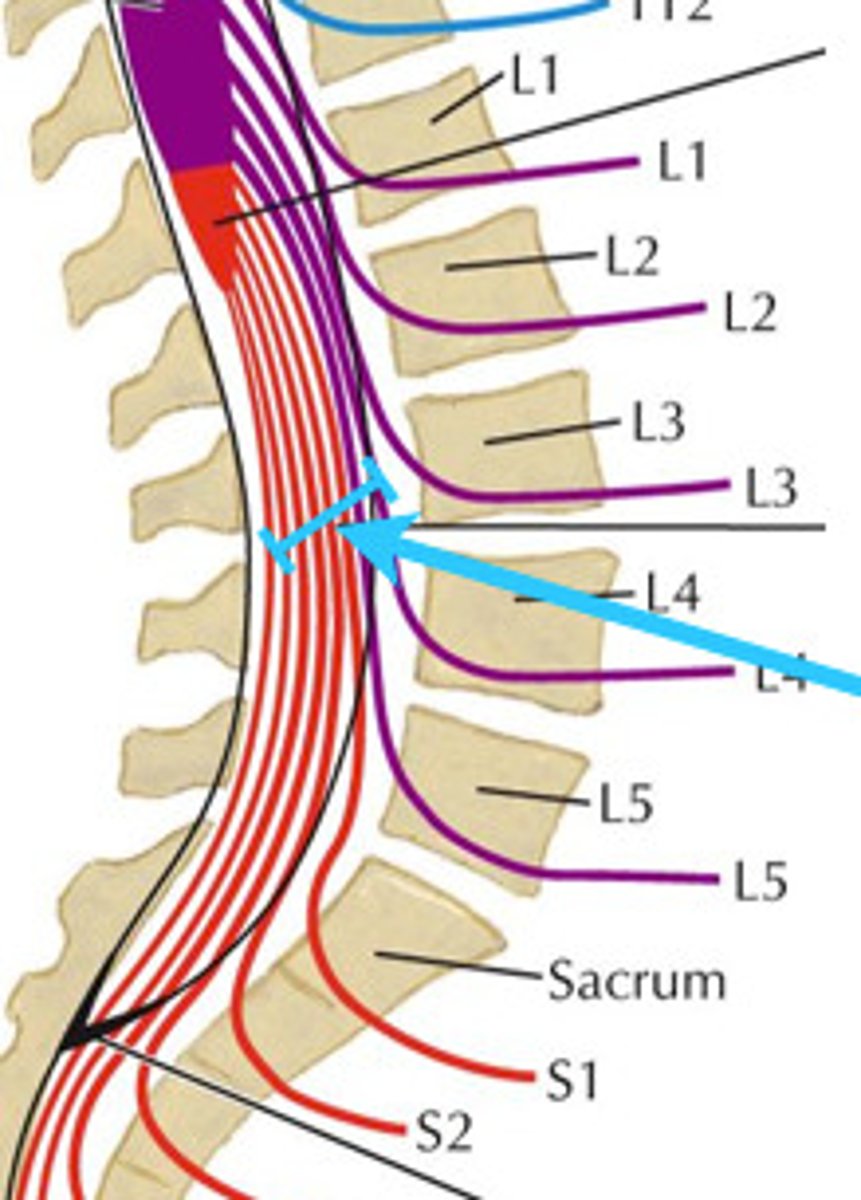 <p>horse tail bundle of spinal nerve roots extending downward from the conus medullaris.</p>