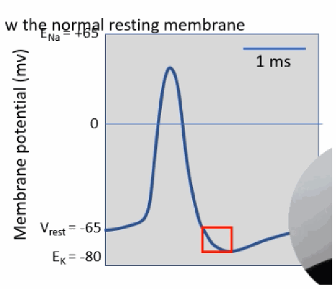 <p>The brief dip below the normal resting potential (below Vrest, approaching EK) that occurs just after repolarisation, before the trace returns to baseline.</p>