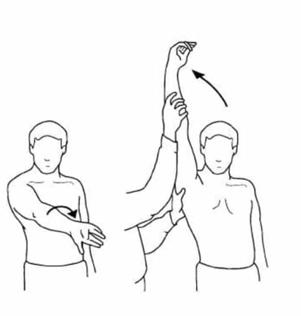 <p><strong>impingement syndrome</strong></p><p>have patient seated- stand behind them</p><p>one hand depress scaplula</p><p>have arm pointing forward and point thumb to ground</p><p>then lift arm up as if asking question</p><p>causes forced flextion in glenohumeral joint</p><p>positive if: pain reproduction on hurt side</p>