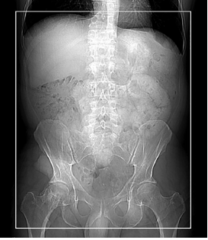 <p>Start location: Just above diaphragm End location: Just below symphysis pubisArterial Venous Liver</p><p>clinical indications: Evaluation of suspected hypervascular hepatic tumors, including hepatocellular carcinoma and metastases from carcinoid, islet cell carcinoma, thyroid carcinoma, renal cell carcinoma, breast carcinoma, melanoma, and sarcomas</p>