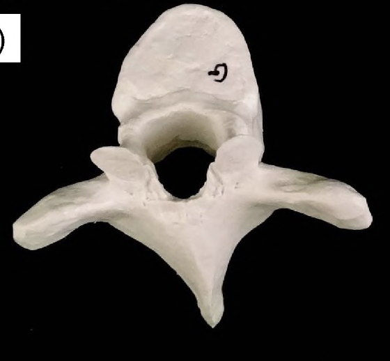 <p>what vertebrae is this?</p>