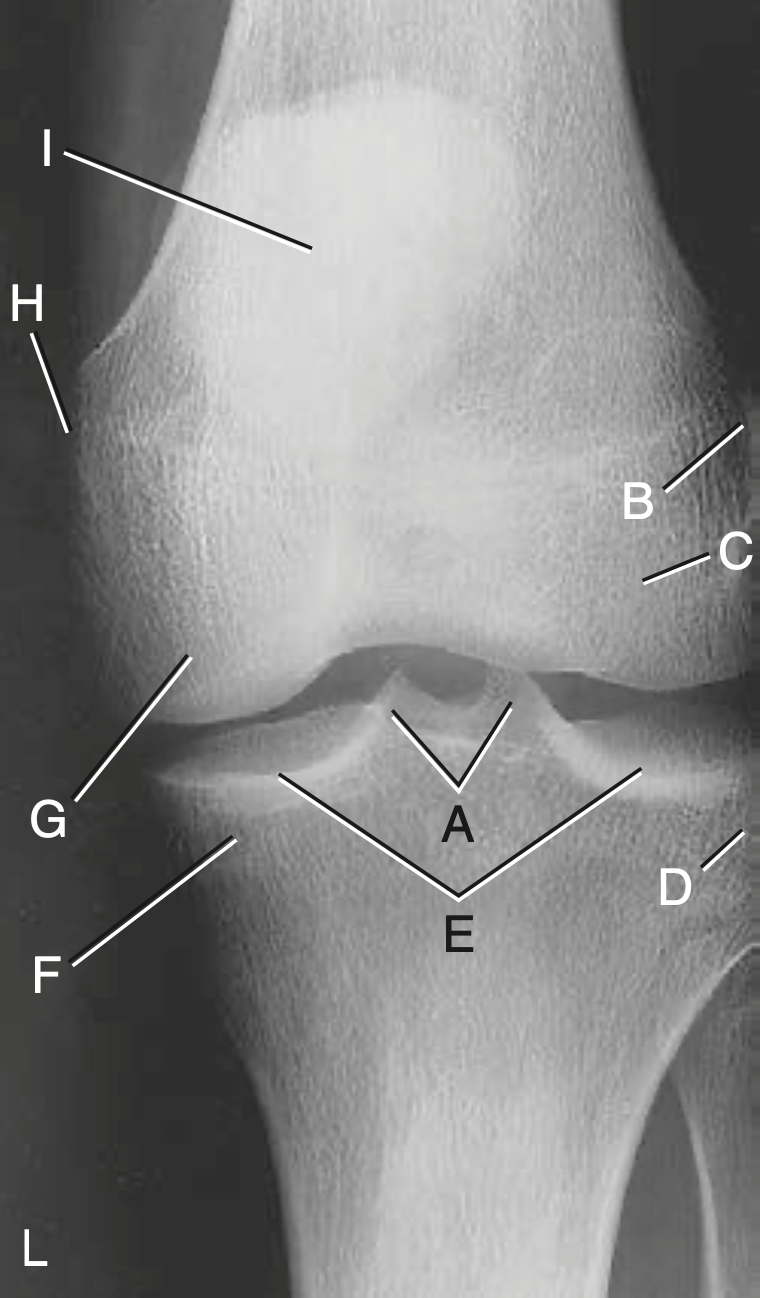 <p>I</p>