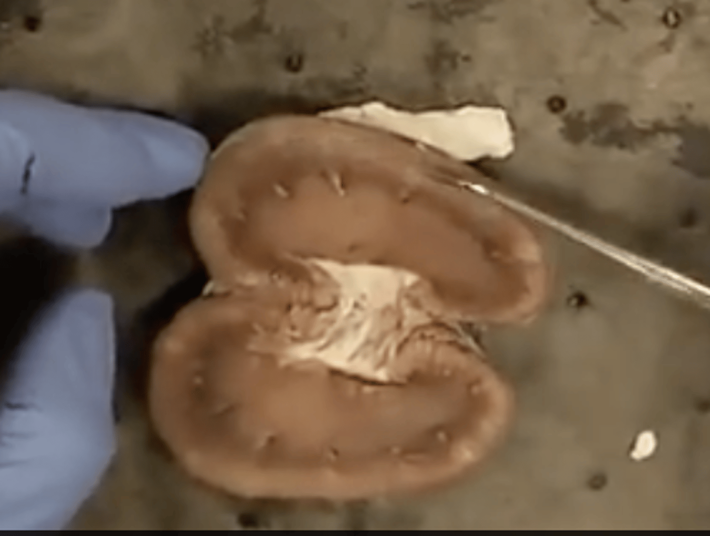 <p>DEFINITION</p><p>Outer layer of the kidney containing glomeruli and convoluted tubules</p>