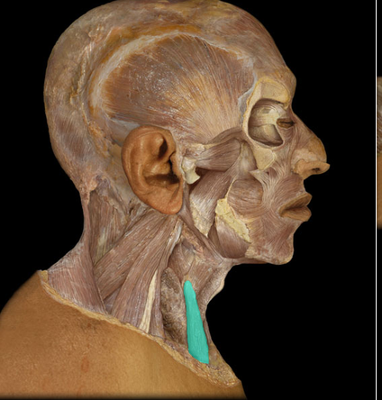 <p>Sternothyroid m.</p>