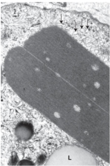 <p>What is the likely composition of Reinke crystals?</p>