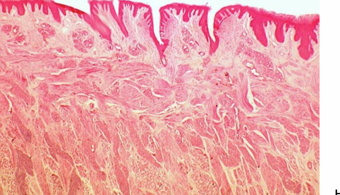 <p>what kind of papillae</p>