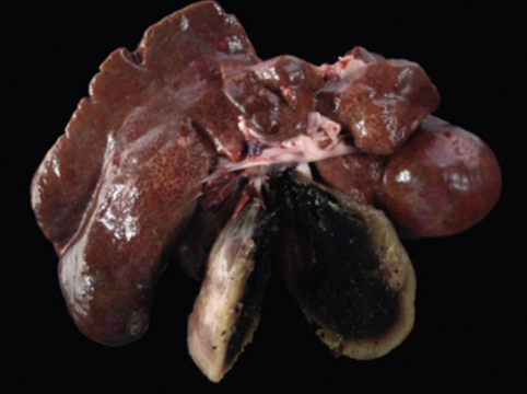 <p><strong>Sätt rätt diagnos på den förändring som ses i bilderna genom att dra rätt ruta till platsen bredvid bilden. Endast en</strong></p><p class="p1"><strong>diagnos per bild. (1.5p)</strong></p>