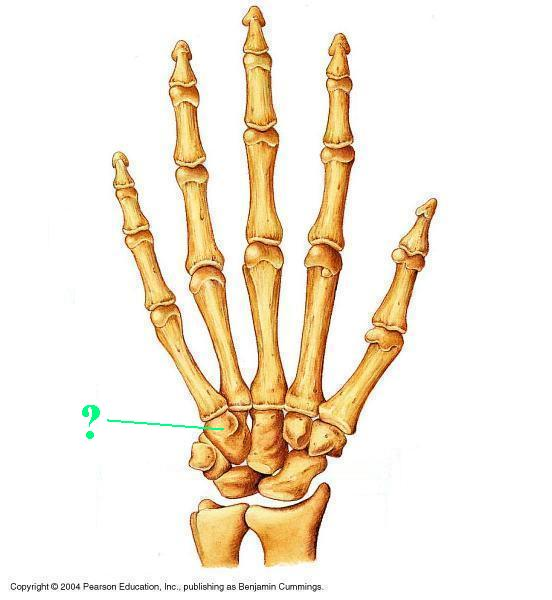 <p>What type (shape) of bone is indicated?</p>