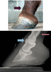 <p>What is the etiology of proximal interphalangeal (pastern) joint OA?</p>