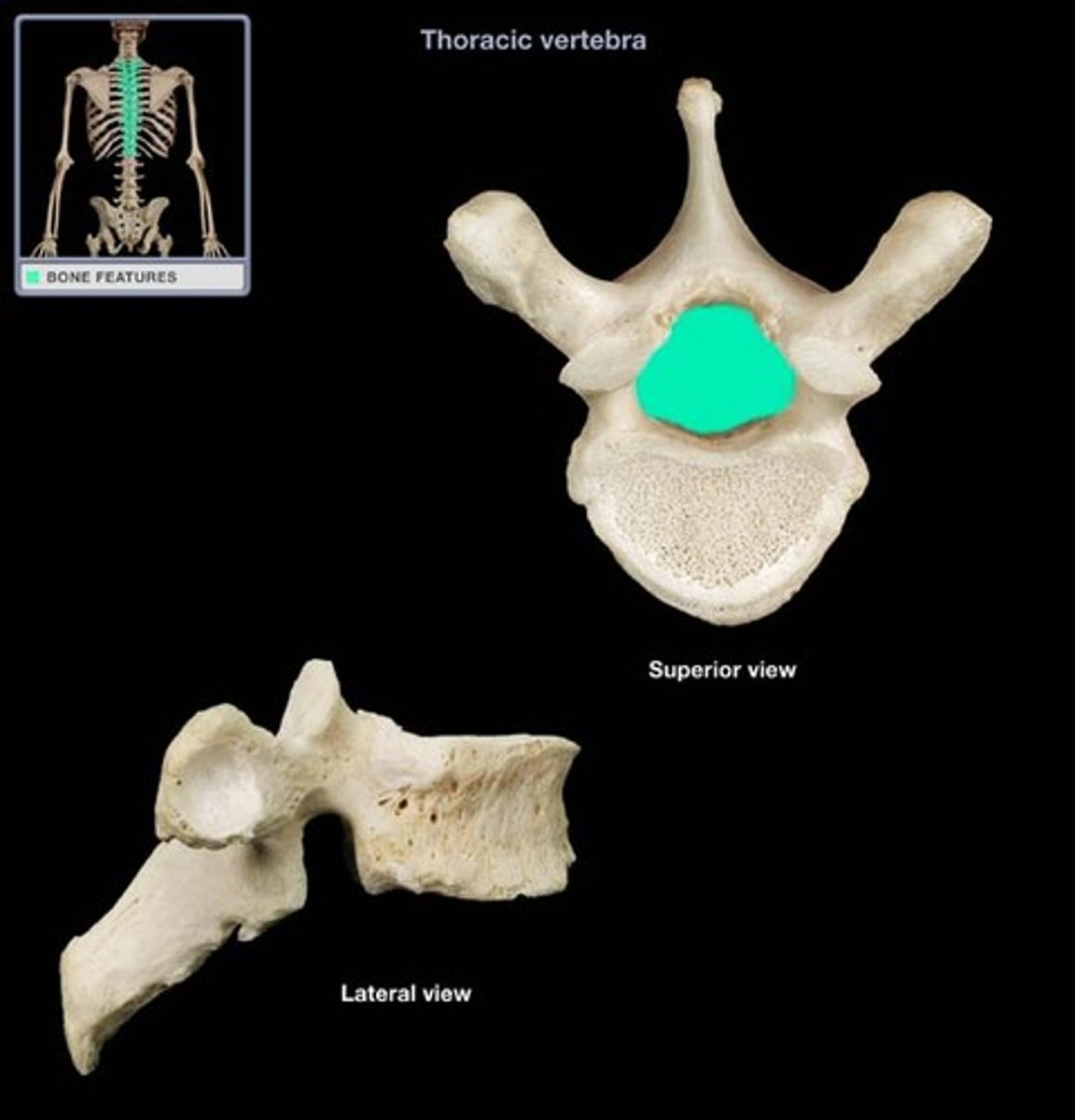 <p>When all vertebrae are together, these holes make the vertebral canal</p>