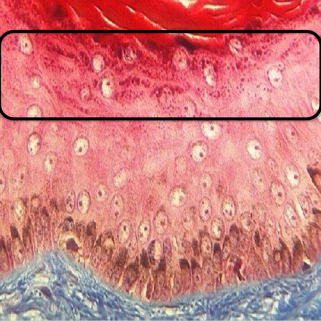 <p>What layer of the epidermis is this?</p>