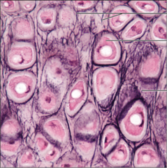 <p>name the tissue: amorphous but firm matrix; extensive elastic fibers in matrix</p>