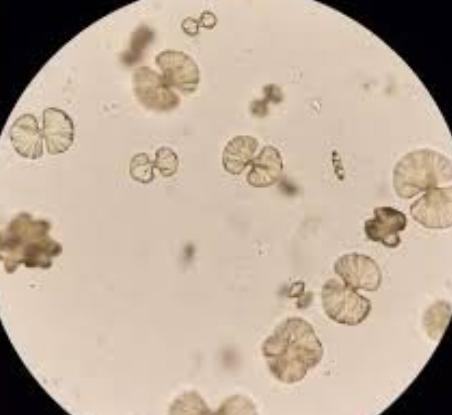 <p>what crystal; acid or alk?</p>