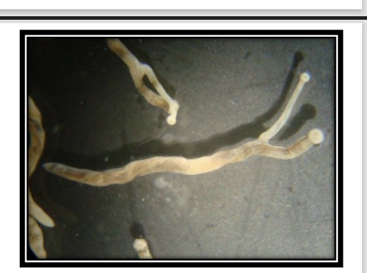 <p>Syngamus trachea life cycle - Adult morpholgy </p>