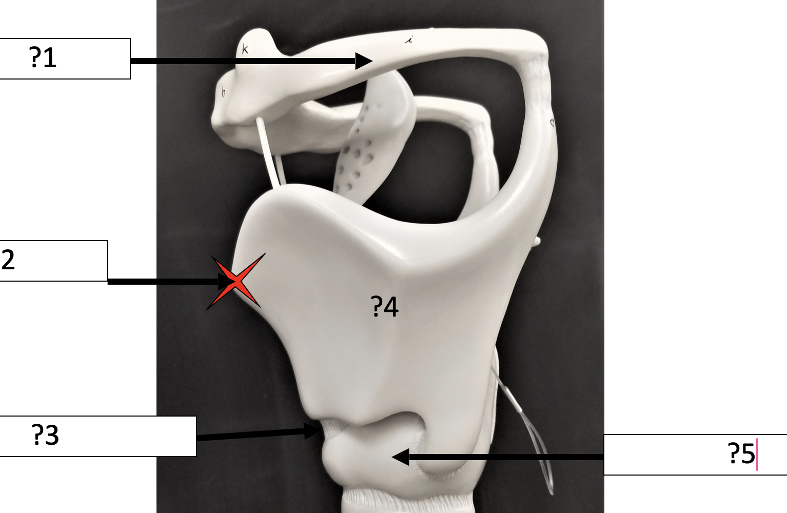 <p>4 Name the structure? </p>
