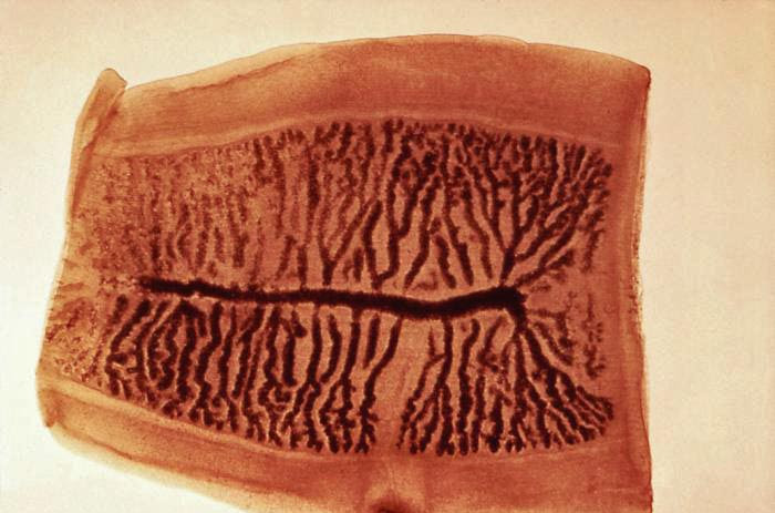 <p><span>How is this flatworm transmitted to humans?</span></p>