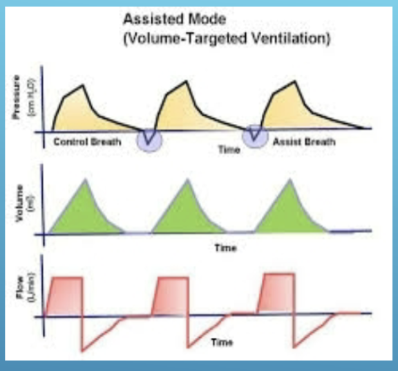 <ul><li><p>______</p><ul><li><p>volume and flow remain constant</p></li><li><p>pressure varies</p></li></ul></li><li><p>trigger</p><ul><li><p>pt</p><ul><li><p>flow pressure</p></li></ul></li><li><p>time</p><ul><li><p>vent</p></li></ul></li></ul></li><li><p>limit</p><ul><li><p>volume</p></li></ul></li><li><p>cycle</p><ul><li><p>time</p></li></ul></li></ul><ul><li><p>guaranteed Ve</p></li><li><p><mark data-color="red" style="background-color: red; color: inherit;">barotrauma</mark></p><ul><li><p>if not well controlled by alarms</p></li></ul></li></ul><p></p>