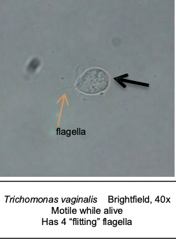 <p>Parasite: Trichomonas</p>
