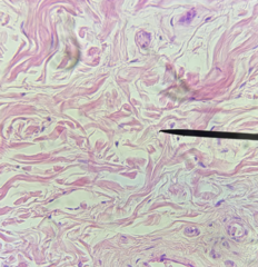 <p>What kind of tissue is this?</p>