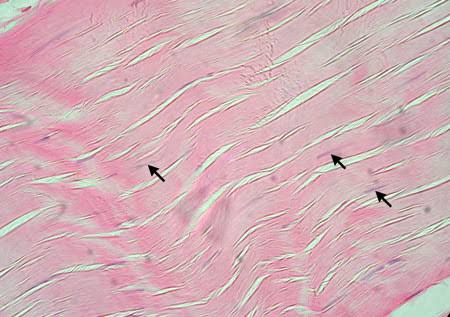 <ul><li><p><em>Characteristic Feature:</em> loose connective adipose tissue, fat cells, <strong>fibroblasts </strong>(active cells that create the extracellular matrix)</p></li><li><p><em>Cell shape/Characteristics:</em> can develop in large groups; fixed amount that enlarge and shrink; looks like bubbles</p></li><li><p><em>Function:</em> used for nutrient storage; hydrolyzes stored triglycerides and secretes fatty acids into blood for oxidation</p></li><li><p><em>Location:</em> under the skin, in bone marrow, and around kidneys&nbsp;</p></li></ul><p></p>