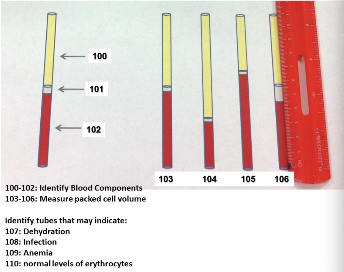 <p>Identify tubes that may indicate Dehydration</p>