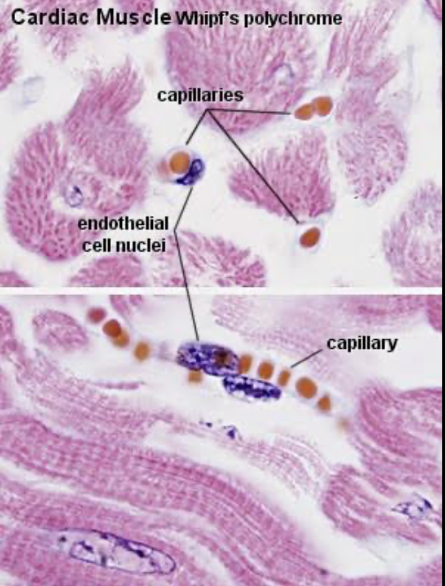 <p>Continous: cells packed with/ tiny cracks (only allows small molecules like water & ions through)</p><p>Fenestrated: tiny pores to allow bigger molcules to pass found in kidney & small intestine for absorbtion</p><p>Sinusoidal: massive large cells that allow for whole cells & proteins to pass (liver, bone marrow & spleen)</p><p></p>