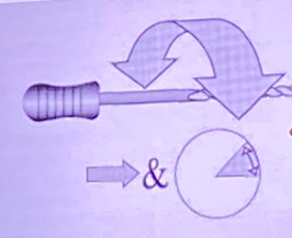 <p>to negotiate canals, achieve patency, and reduce instrument stress</p><p><span style="color: red;">back-and-forth oscillation</span> of a file (<span style="color: red;">30–60° right</span> and <span style="color: red;">30–60° left</span>) as the instrument is <span style="color: red;">pushed forward</span> into the canal</p><ul><li><p><strong>procedure tips:</strong></p><ul><li><p>start with watch-winding to check canal patency</p></li><li><p>if the canal is <span style="color: red;">constricted/narrow</span> → continue with this motion</p></li><li><p>if the canal is<span style="color: red;"> wide</span> → use<span style="color: red;"> filing motion</span></p></li><li><p>filing is performed last, after initial canal negotiation.</p></li></ul></li><li><p><span style="color: red;">clockwise</span> rotation: <span style="color: red;">pushes the file tip </span>and working edges into the canal.</p></li><li><p><span style="color: red;">counter</span>clockwise rotation: partially <span style="color: red;">cuts away</span> engaged dentin.</p></li></ul><p></p>
