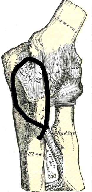 <p>What joint is this within the <strong>Upper-Appendicular Skeleton?</strong></p>
