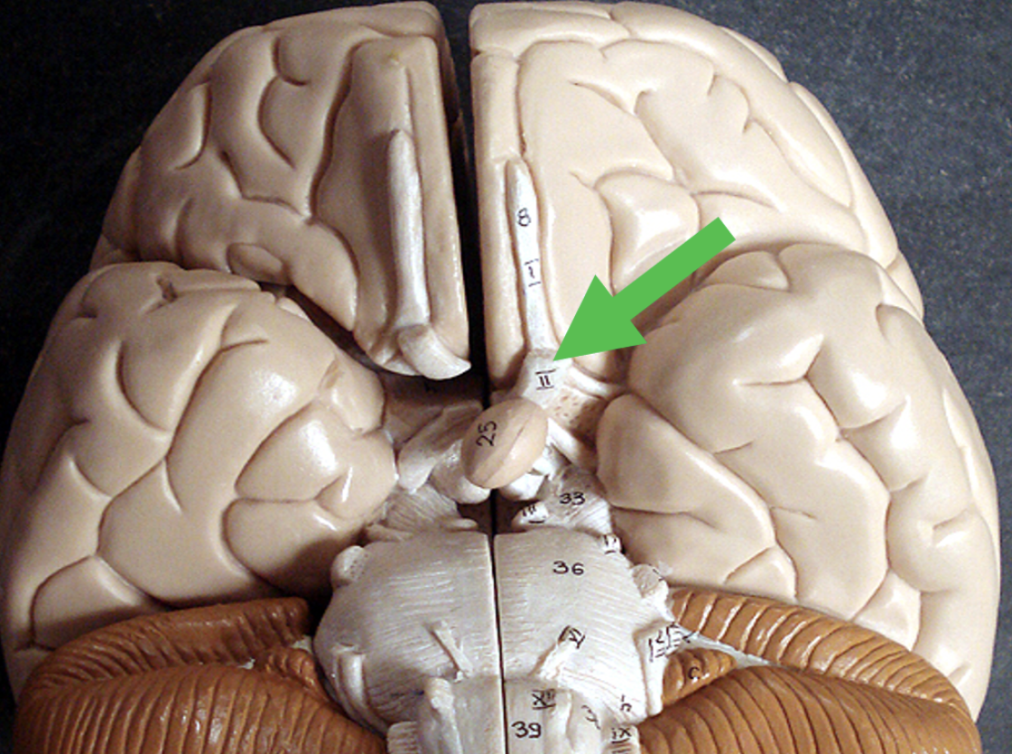 <p>Identify the area of the brain at the tip of the pointer.</p>