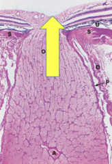 <p>identify the transitional region</p>