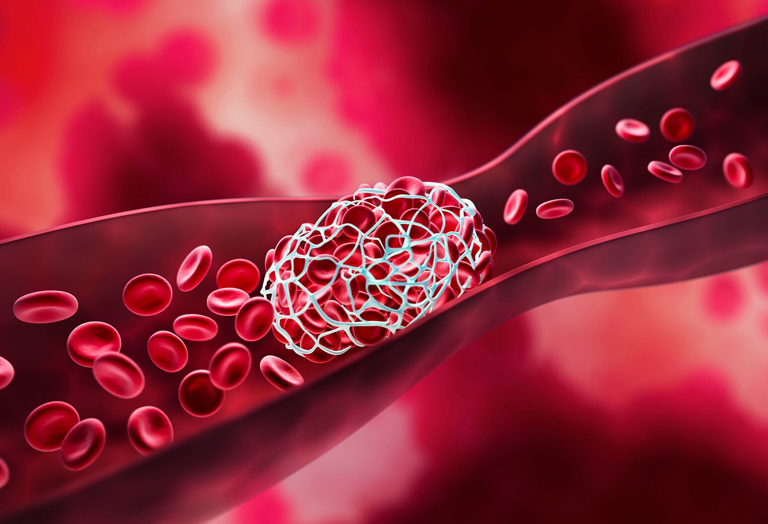<p>polymerized protine clot </p>