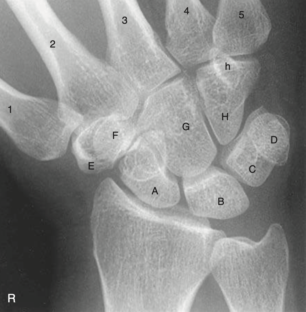 <p>G</p>