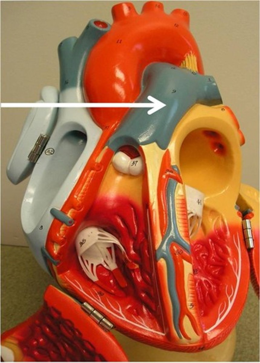 <p>pulmonary trunk</p>