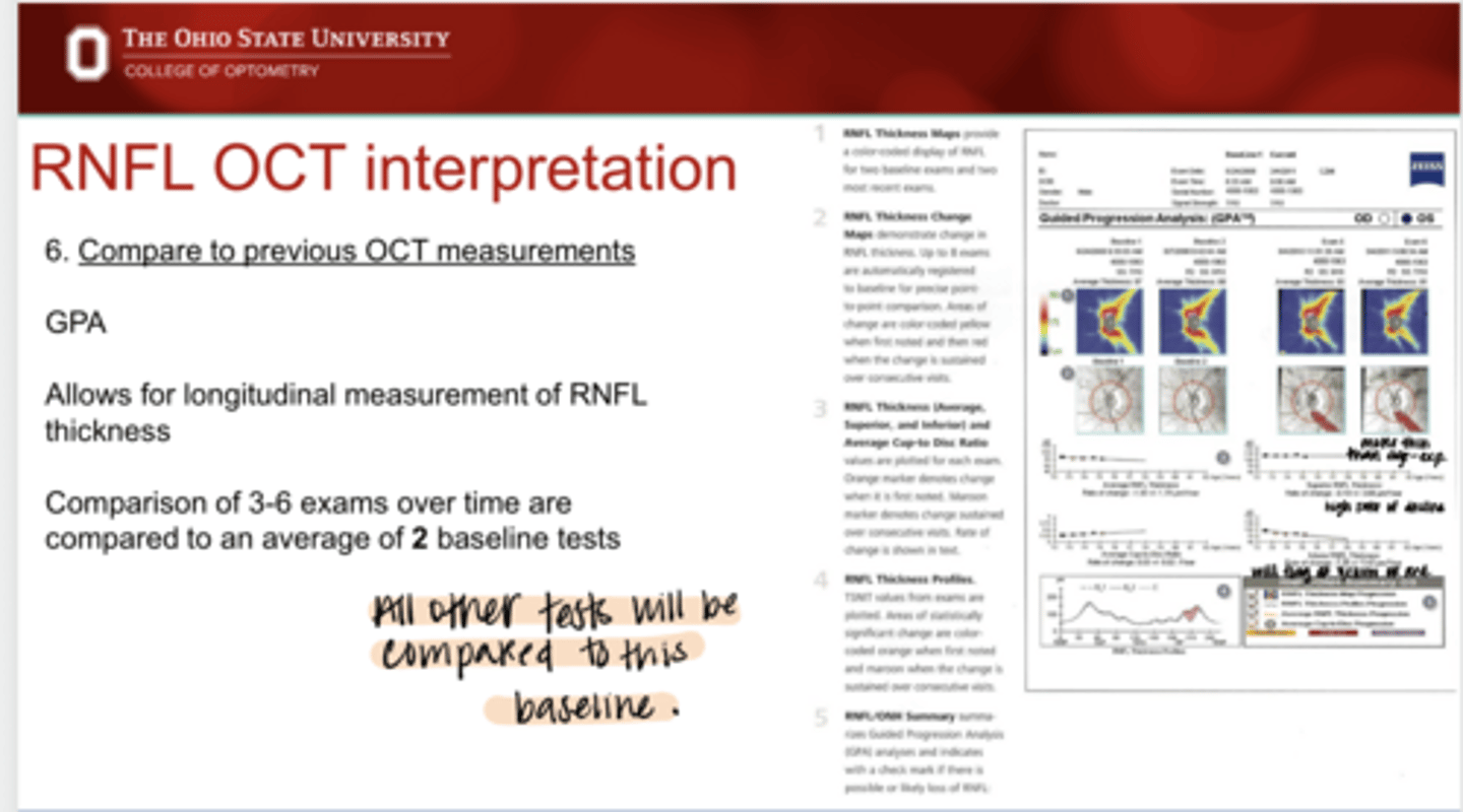 <p>What does Guided Progression Analysis (GPA) allow for?</p>