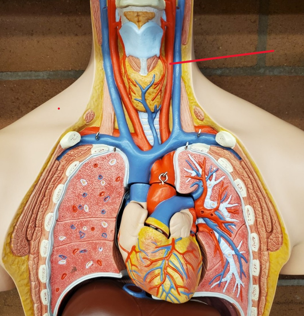 <p>Name the artery</p>