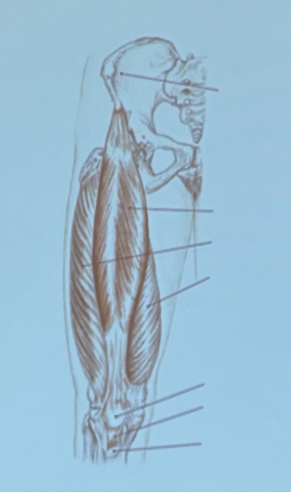 <p>Muscle name?</p>