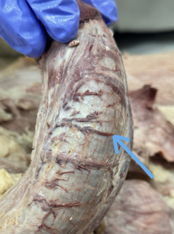 <p><span>artery provides oxygenated blood to the gland of the penis </span></p>