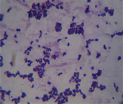 <p>Spheres</p><ul><li><p>Streptococcus (Chain) (Over 50 species)</p></li><li><p>Staphylococcus (Cluster)</p></li></ul><p></p>