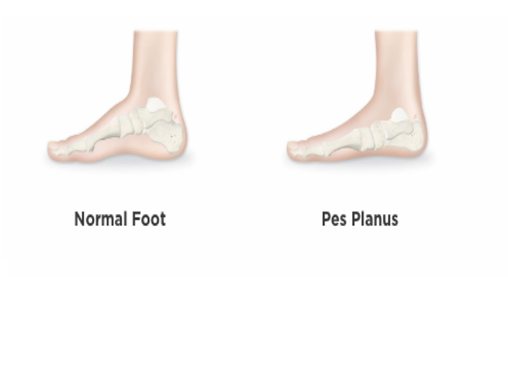 <p>What injury / condition? </p>