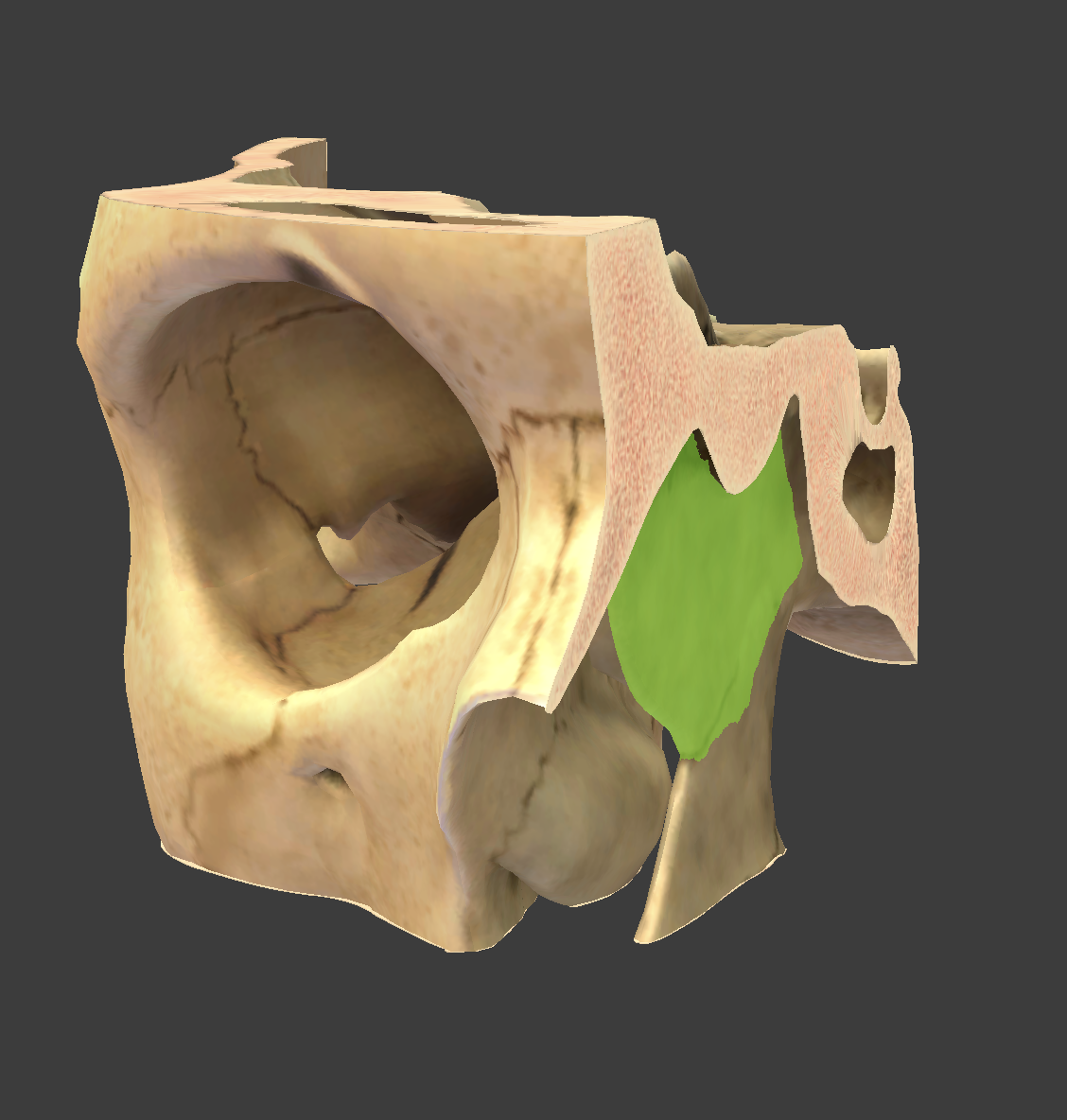 term image