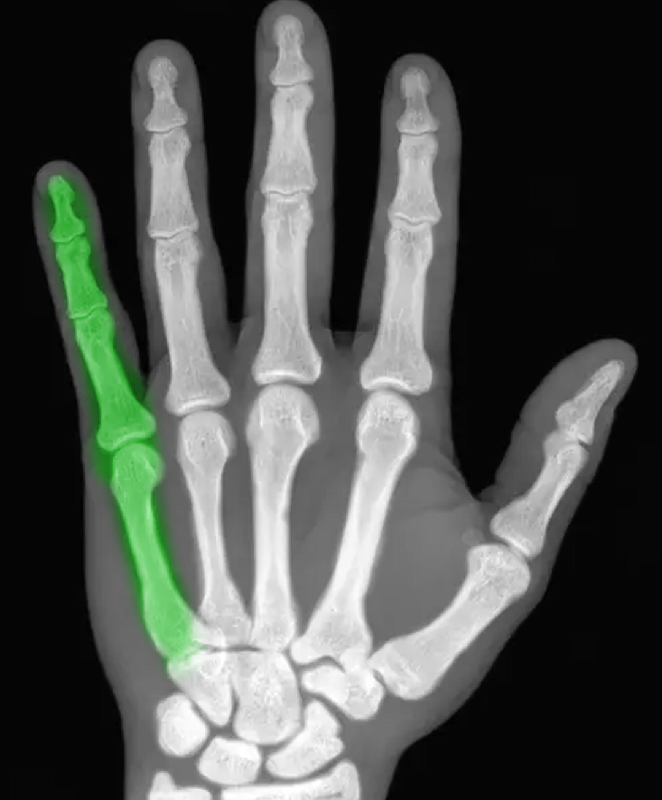 <p>What numeral corresponds to the bones highlighted in green?</p>