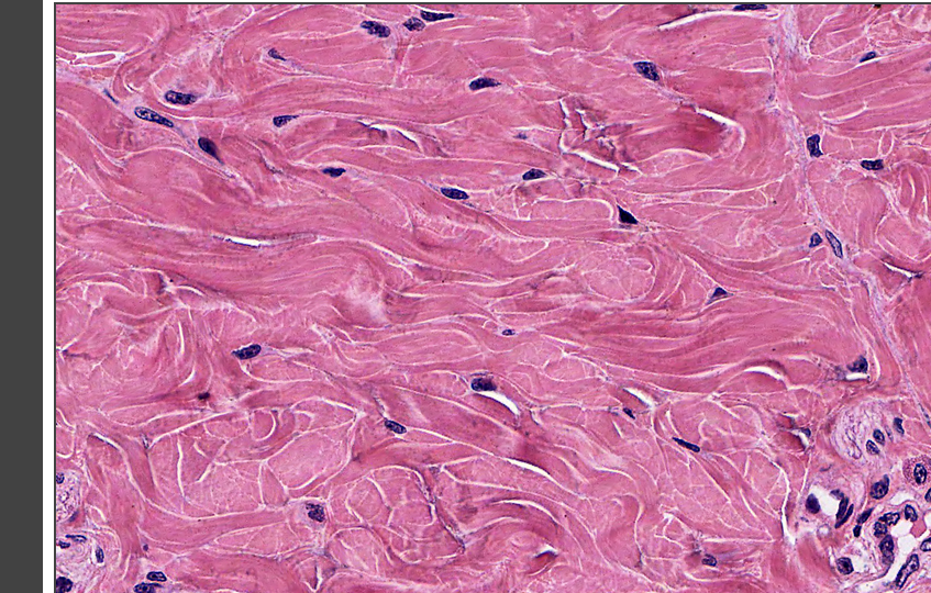 <p>what tissue is this</p>
