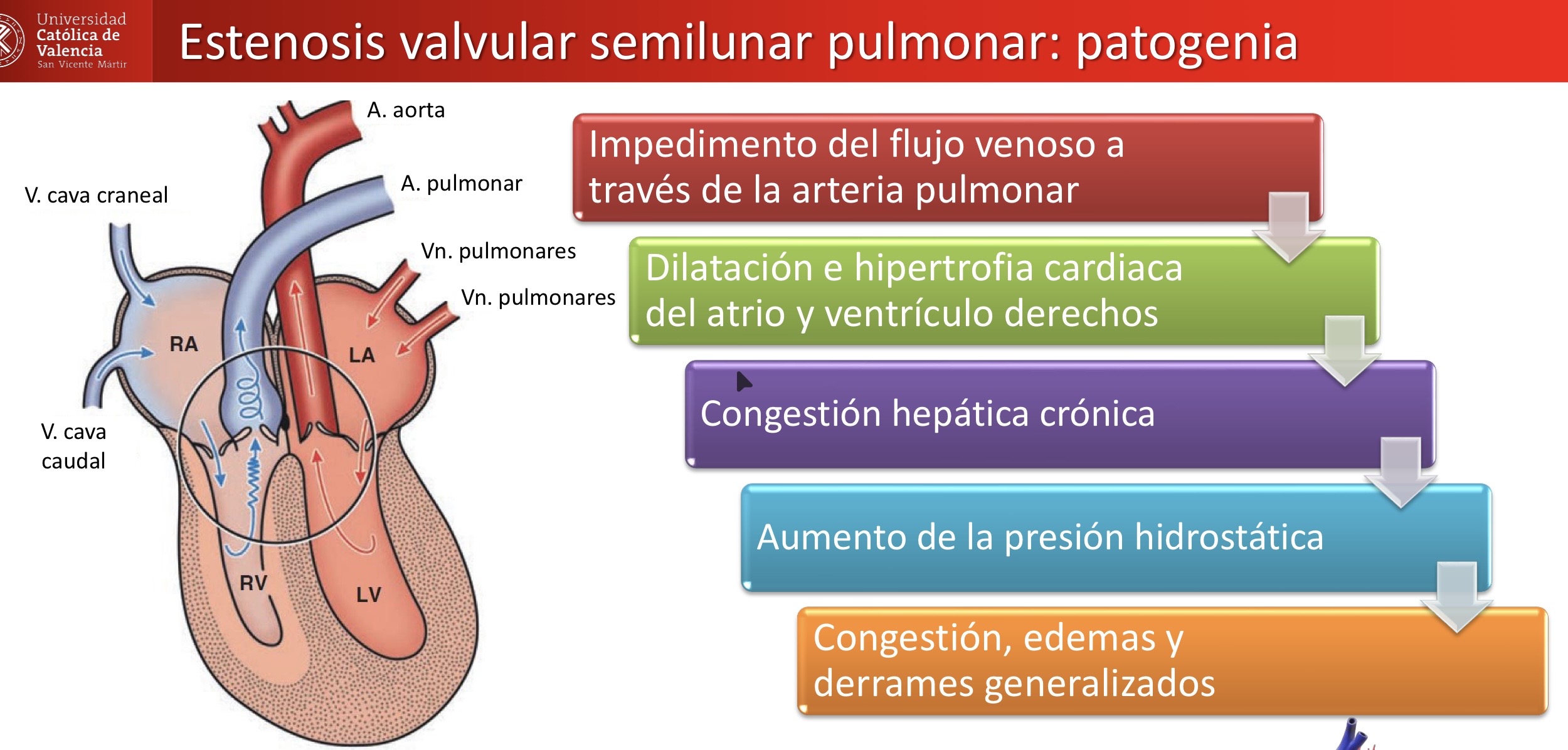 <p>CARDIOVASCULAR: estenosis valvular semilunar pulmonar </p><p>Lesiones asociadas: congestión hepatica, sinusoides hepaticos llenos de eritrocitos </p>