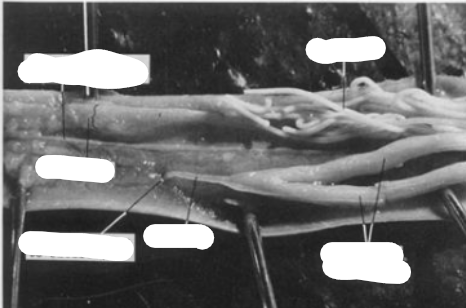 <p>What is this parasite and what are the structures </p>